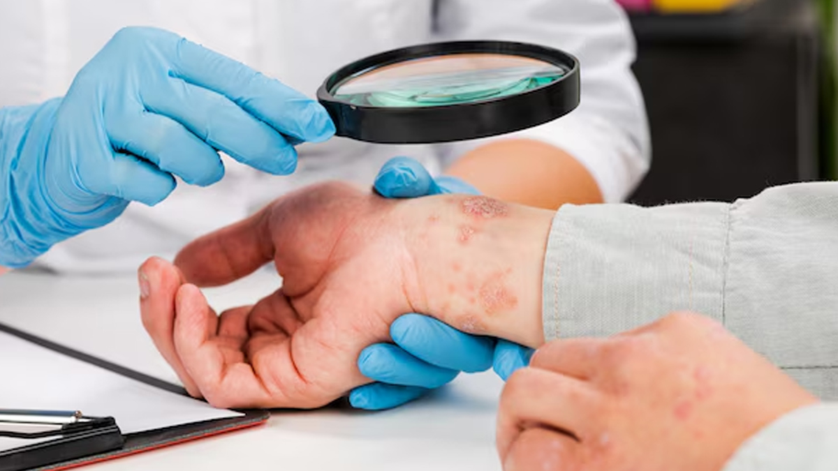 is syphilis sexually transmitted disease 1 (3)