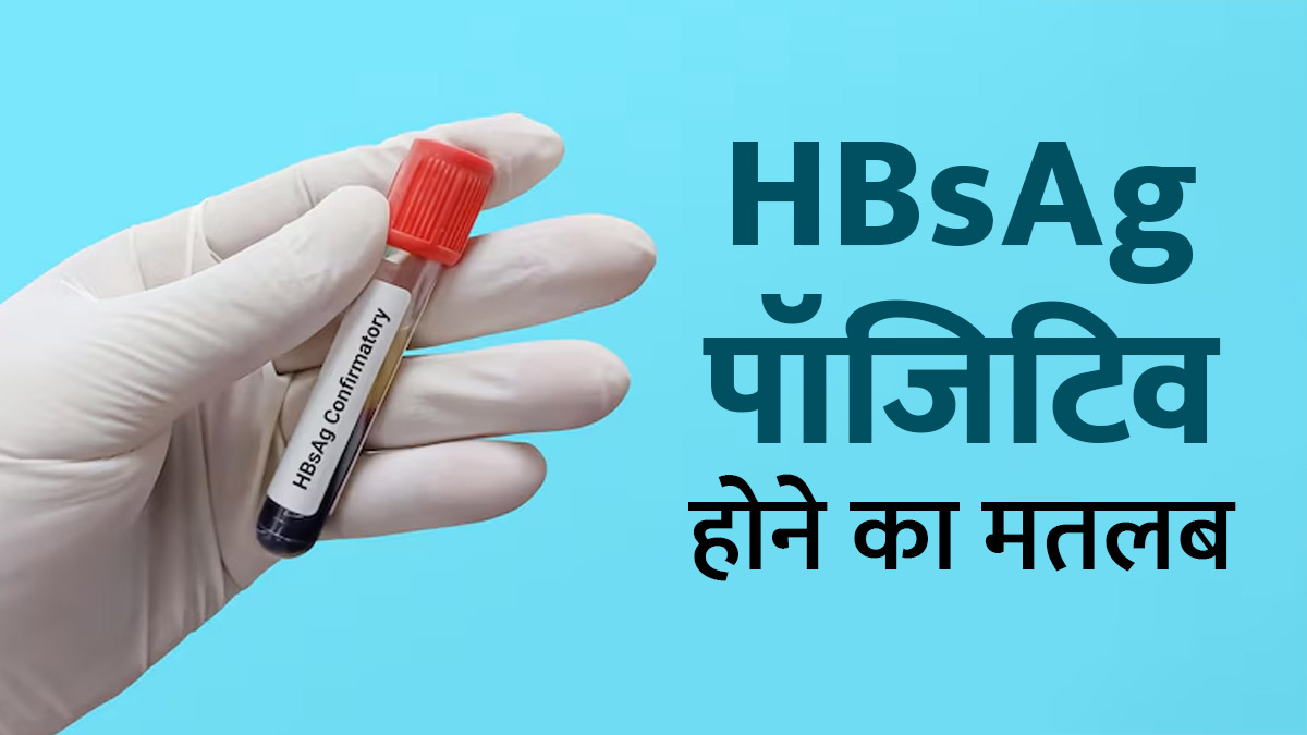 HBsAg पॉजिटिव होने का क्या मतलब है? जानें यह हेपेटाइटिस B का संकेत है या नहीं