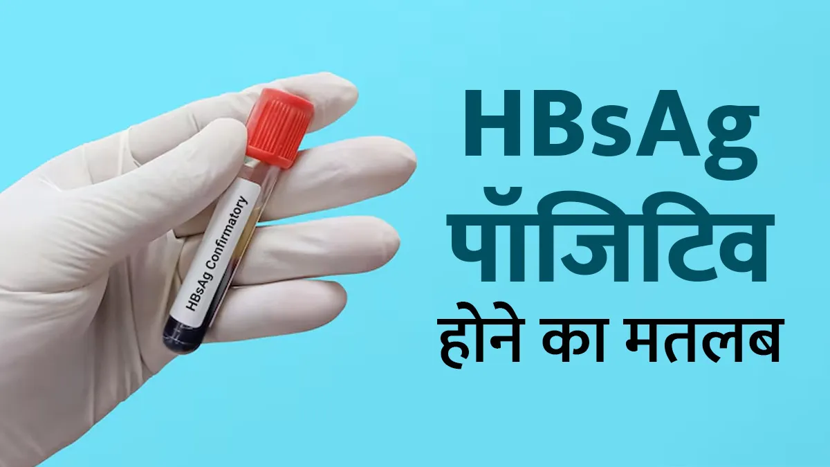HBsAg पॉजिटिव होने का क्या मतलब है? जानें यह हेपेटाइटिस B का संकेत है या नहीं