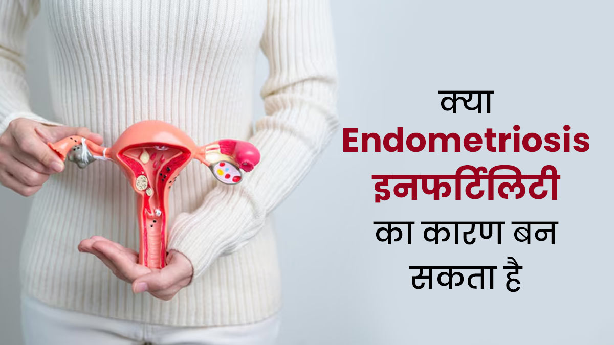 क्या एंडोमेट्रियोसिस इनफर्टिलिटी का कारण बन सकता है? समझें डॉक्टर से