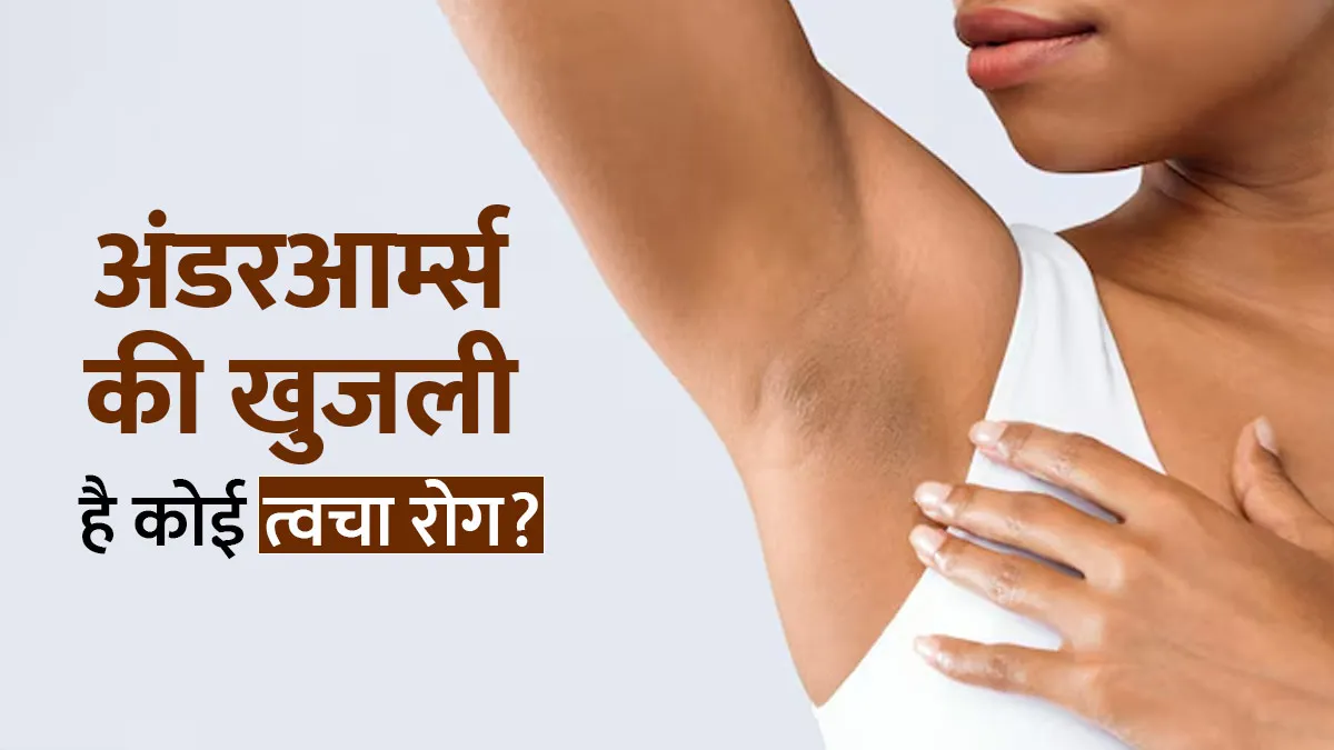 गर्मि‍यों में अंडरआर्म्स की खुजली त्‍वचा रोग का संकेत तो नहीं? जानें डॉक्‍टर की राय