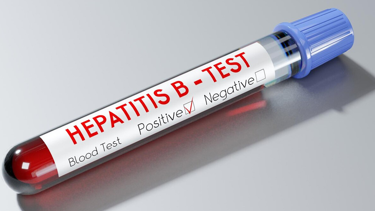 HBsAg-positive-test