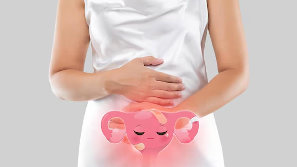 can endometriosis cause back pain 01 (6)