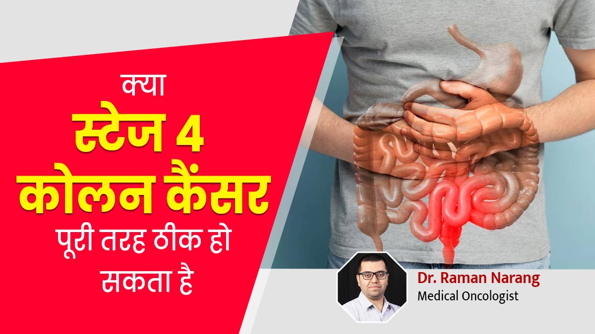 क्या स्टेज 4 कोलन कैंसर पूरी तरह ठीक हो सकता है? इस कैंसर के होने पर रोगी के जीने की संभावना कितनी होती है?