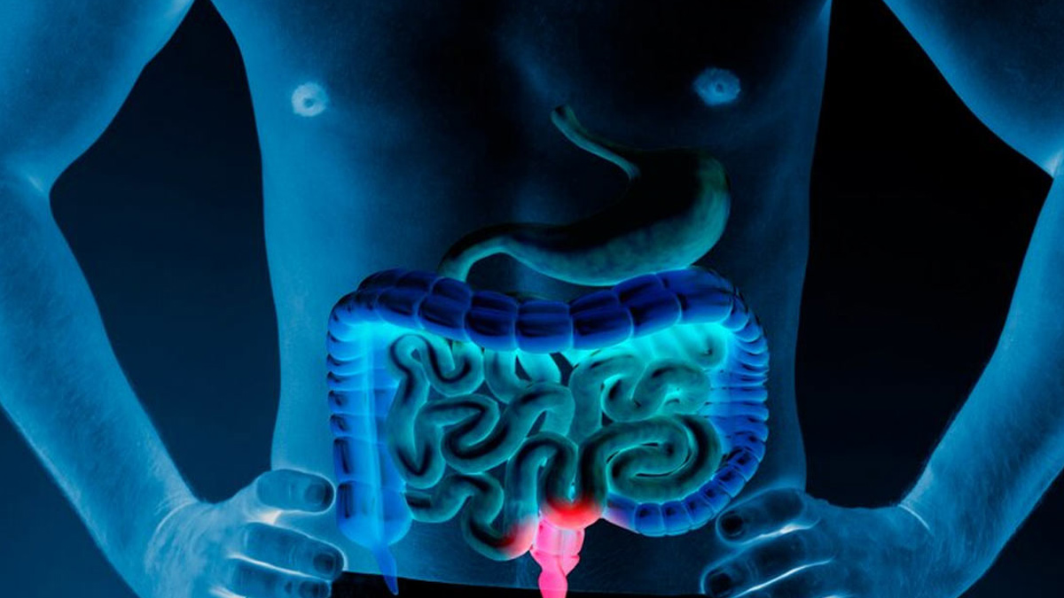 Colan-cancer-inside3