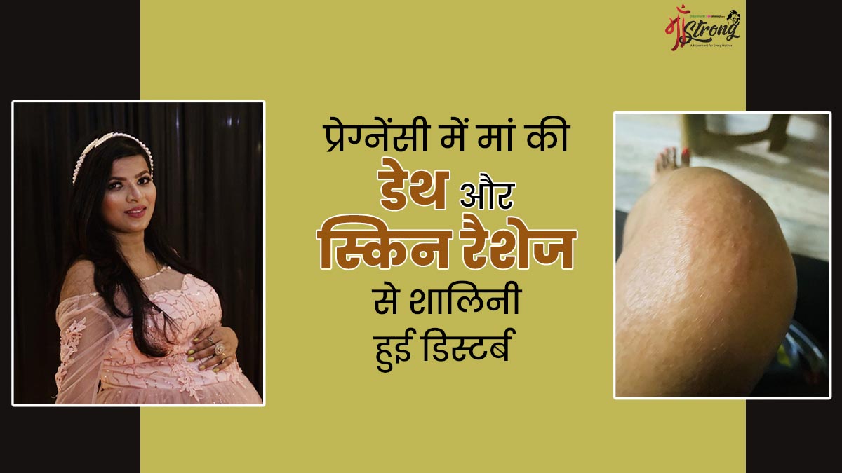 प्रेग्नेंसी में मां की डेथ और स्किन रैशेज से हुई डिस्टर्ब, जानें गोरखपुर की शालिनी की इमोशनल जर्नी