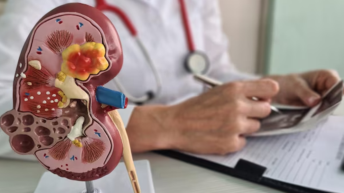 causes-of-hydronephrosis