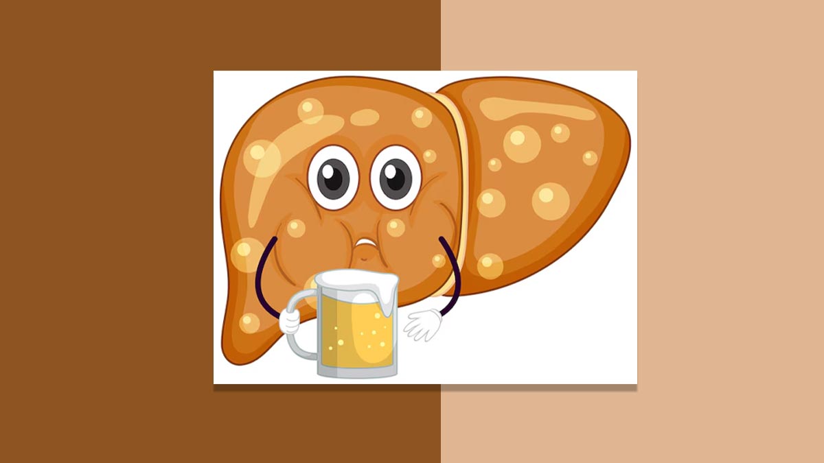 fatty liver