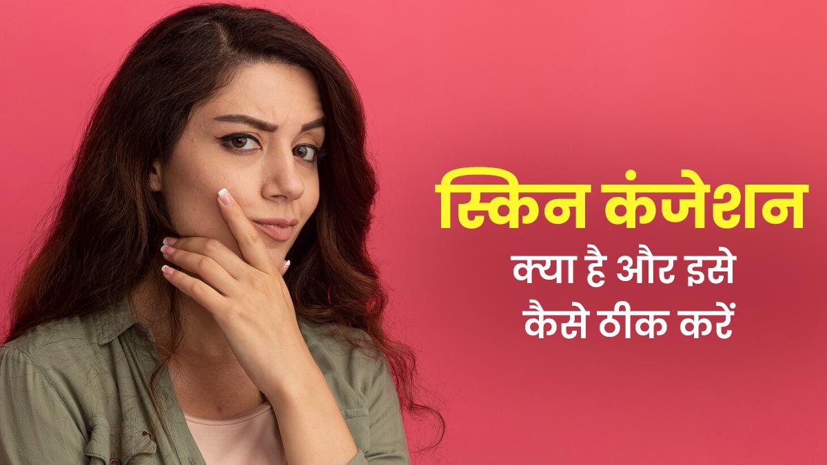 क्या होता है स्किन कंजेशन? डॉक्टर से जानें इसके कारण और इलाज