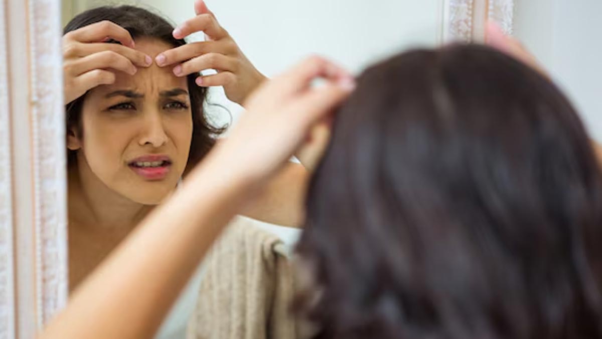 What Is Skin Congestion