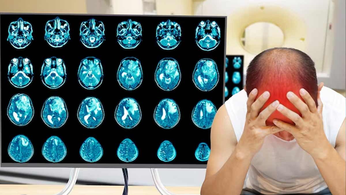 World-Brain-Tumor-Day