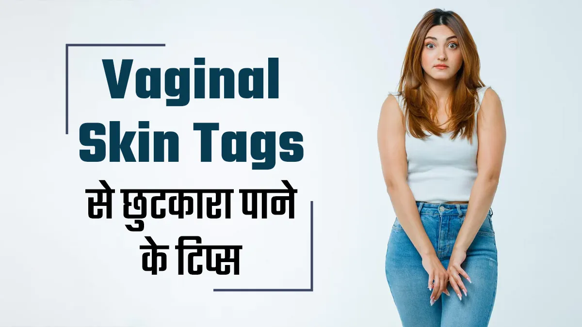 क्या आप भी हैं Vaginal Skin Tags से परेशान? जानें इससे छुटकारा पाने के टिप्स