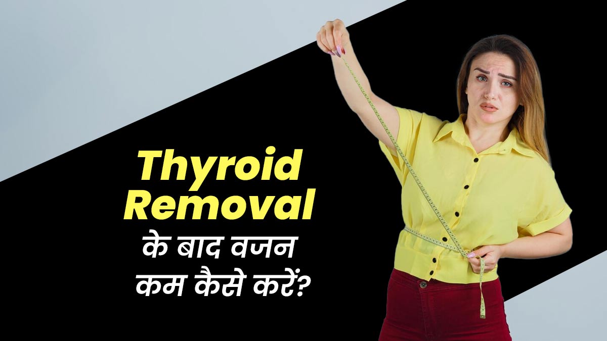 थायराइड ग्लैंड रिमूव करने के बाद कैसे करें वजन कम? अपनाएं डॉक्टर के बताए ये 4 टिप्स