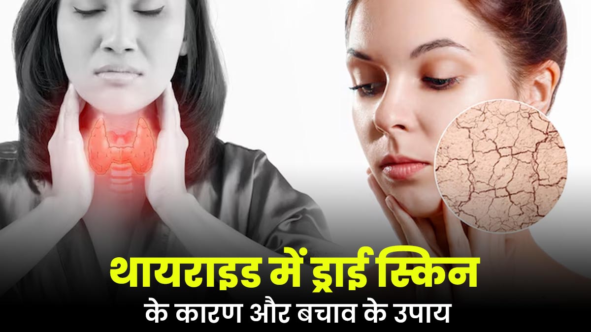 थायराइड में क्यों होती है ड्राई स्किन की समस्या? राहत के लिए करें ये उपाय