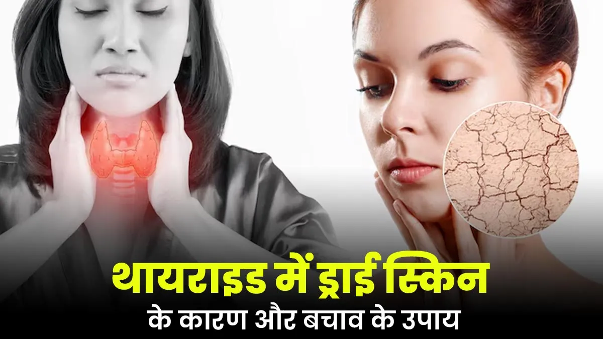 थायराइड में क्यों होती है ड्राई स्किन की समस्या? राहत के लिए करें ये उपाय