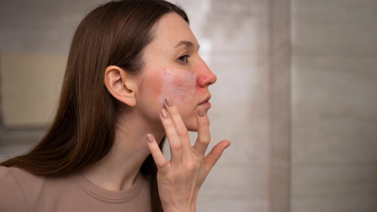 why does thyroid cause dry skin problem and remedies for relief in hindi 01 (3)