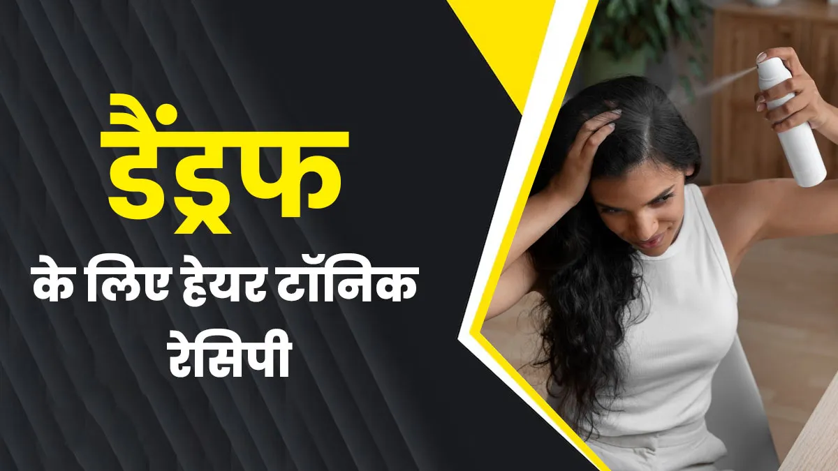 डैंड्रफ की समस्या से राहत पाने के लिए इस्तेमाल करें ये स्पेशल आयुर्वेदिक टॉनिक, बाल रहेंगे हेल्दी
