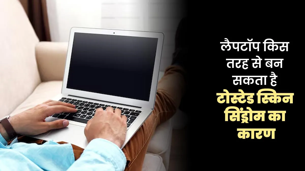 लैपटॉप किस तरह से बन सकता है टोस्टेड स्किन सिंड्रोम का कारण, डॉक्टर से जानें