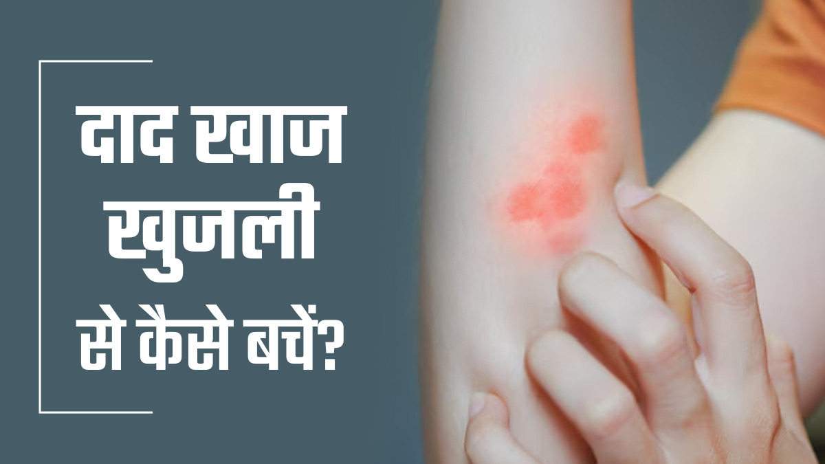 गर्मियों में दाद, खाज और खुजली से कैसे बचें? डॉक्‍टर से जानें उपाय