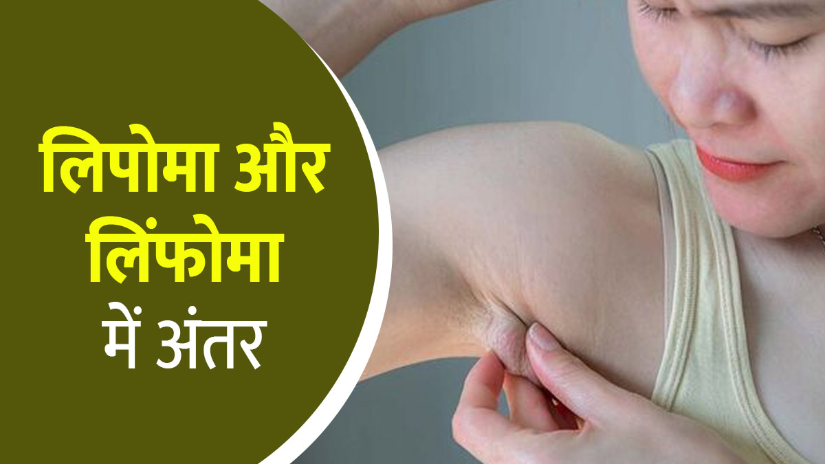 लिपोमा और लिंफोमा रोग में क्‍या अंतर है? डॉक्‍टर से जानें