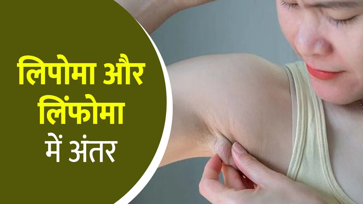 लिपोमा और लिंफोमा रोग में क्या अंतर है? डॉक्टर से जानें
