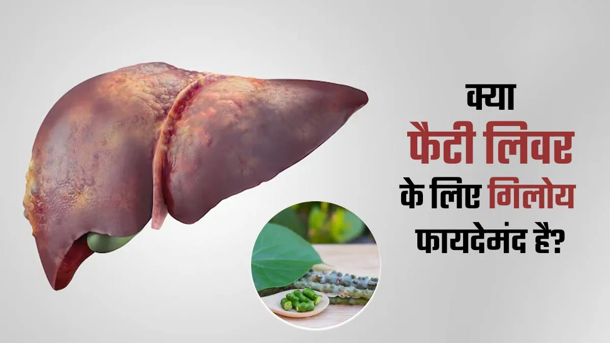 क्या फैटी लिवर के लिए फायदेमंद है गिलोय? एक्सपर्ट से जानें