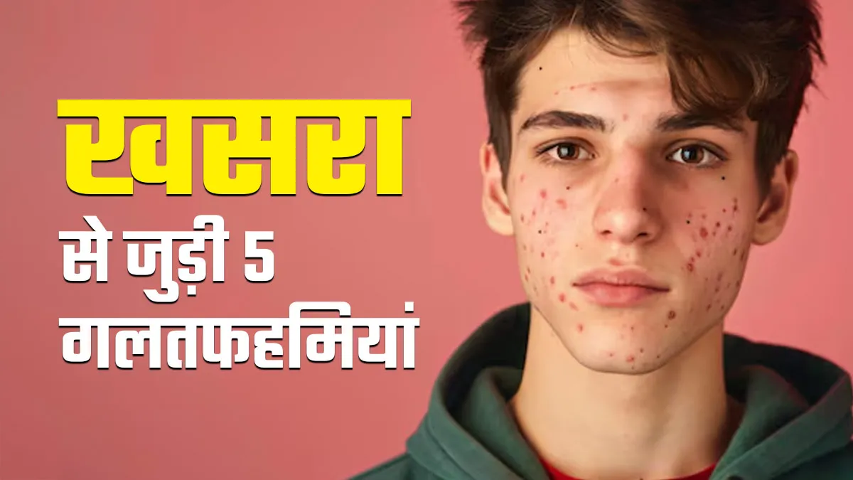 खसरा को लेकर फैली इन 5 गलतफहमियों से रहें सावधान, डॉक्टर की चेतावनी
