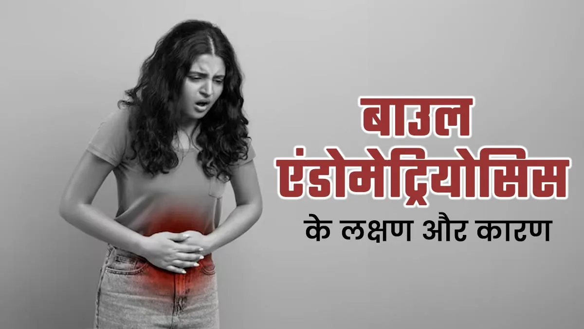बाउल एंडोमेट्रियोसिस के क्या कारण हो सकते हैं? जानें इसके लक्षण