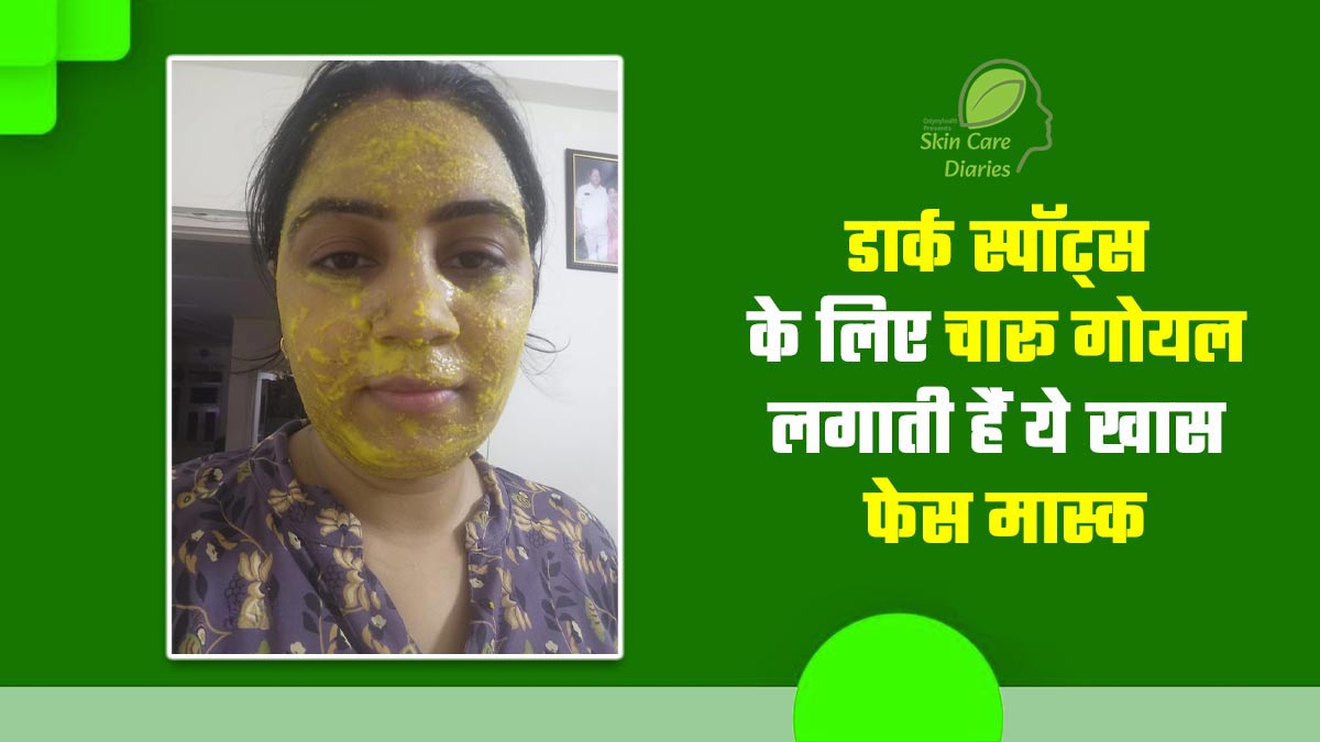 डार्क स्पॉट्स के लिए चारू गोयल लगाती हैं बेसन और आलू से बना यह खास फेस मास्क, स्किन डलनेस से भी मिली राहत