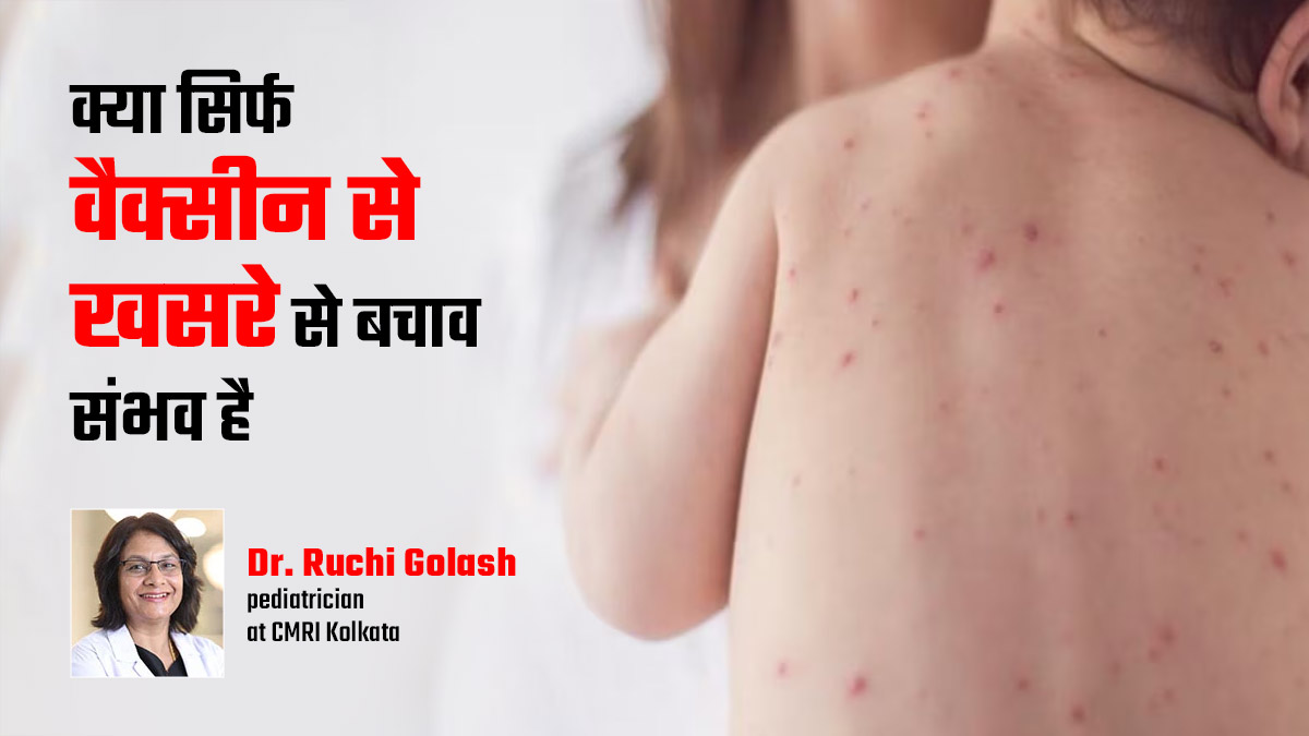 बच्चे को खसरा होने पर क्या करना चाहिए और क्या नहीं, बता रहे हैं डॉक्टर