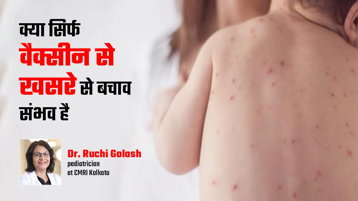 बच्चे को खसरा होने पर क्या करना चाहिए और क्या नहीं, बता रहे हैं डॉक्टर