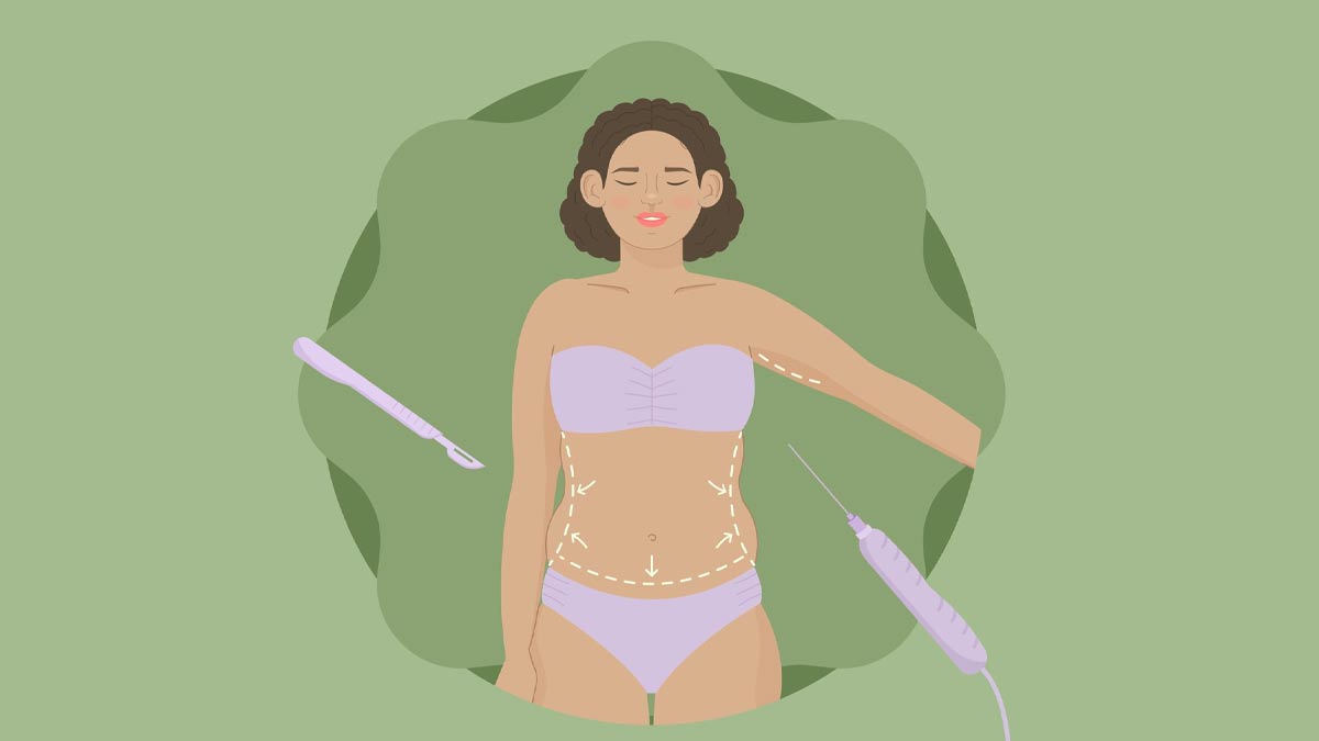 can you do yoga after c section 01 (7)