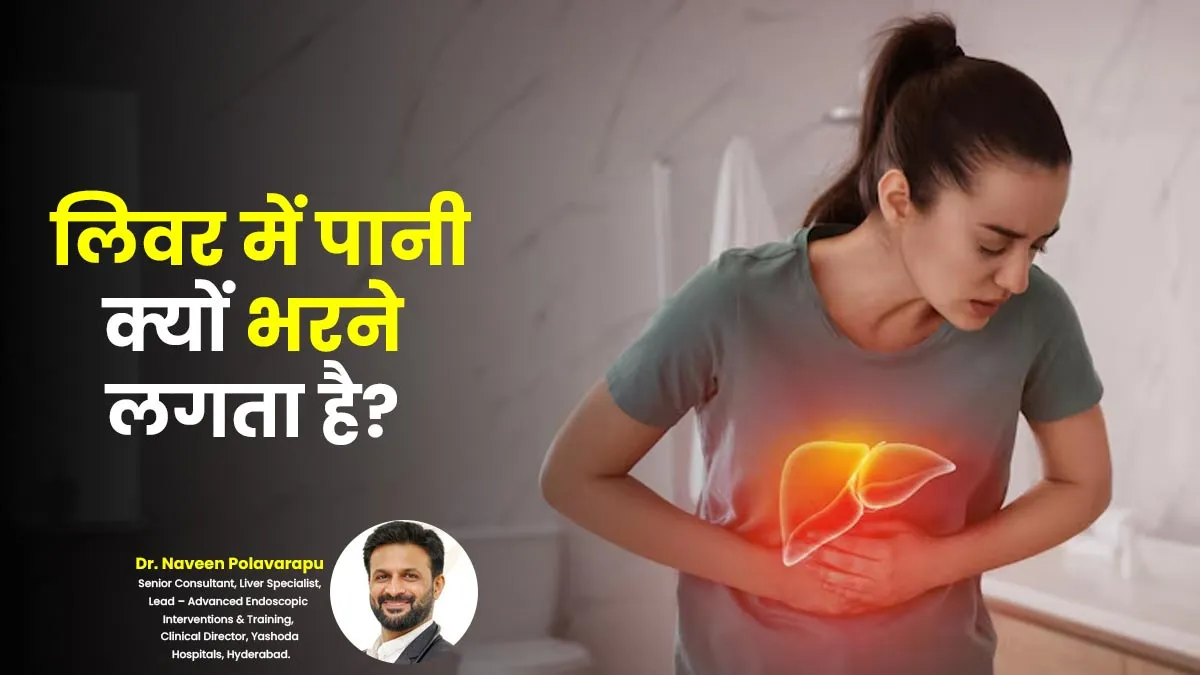लिवर में पानी क्यों भरने लगता है? डॉक्टर से जानें इसके कारण
