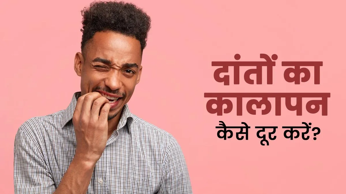 दांतों के कालेपन से हैं परेशान? डॉक्टर से जानें हटाने के आसान तरीके