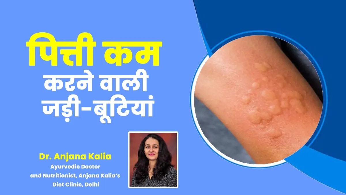 पित्ती से राहत पाने के लिए करें इन 7 जड़ी-बूटियों का इस्तेमाल, खुजली भी होगी कम