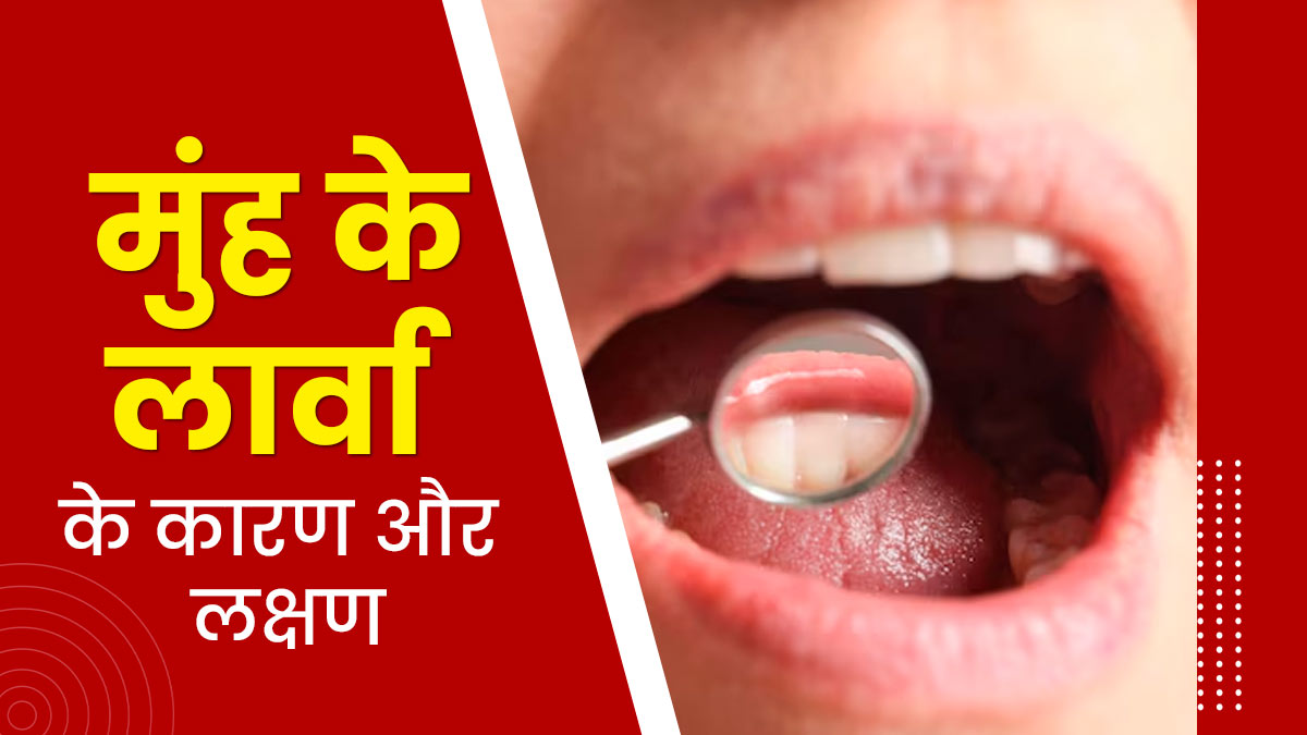 मुंह के लार्वा की समस्या क्या है? जानें इसके कारण और लक्षण