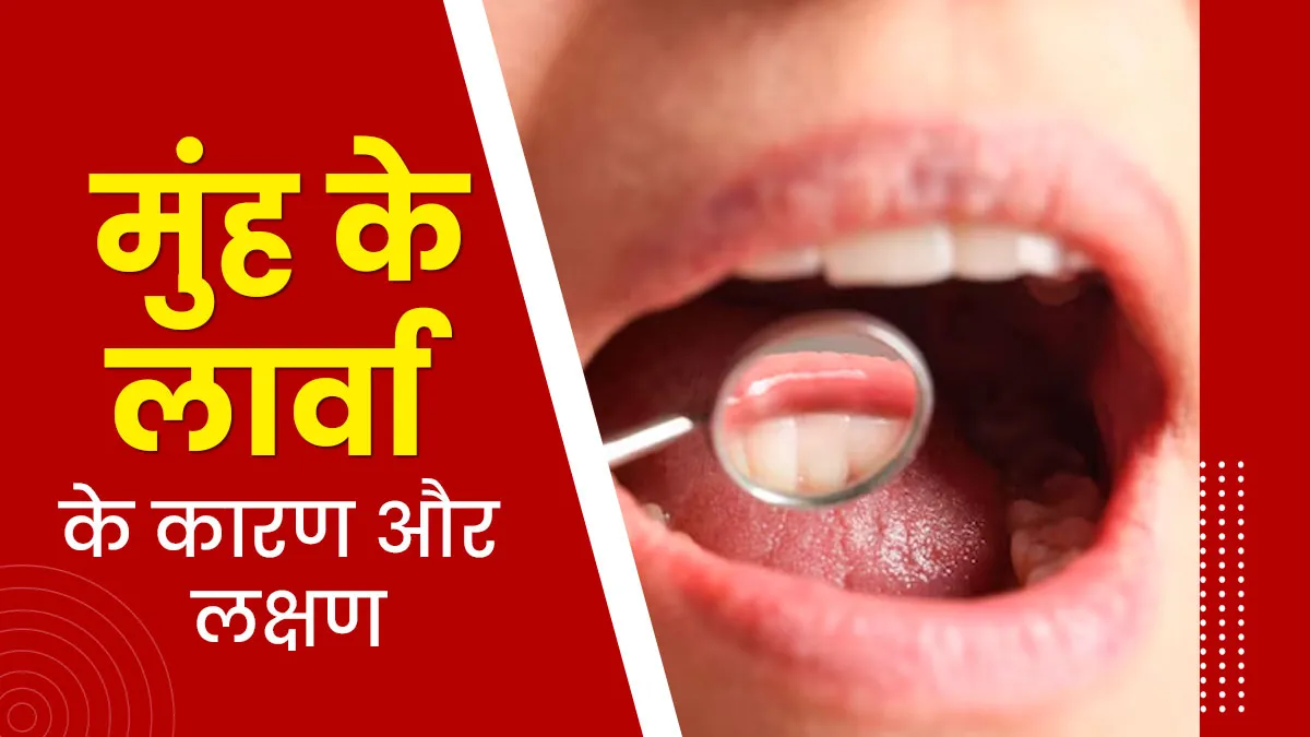 मुंह के लार्वा की समस्या क्या है? जानें इसके कारण और लक्षण