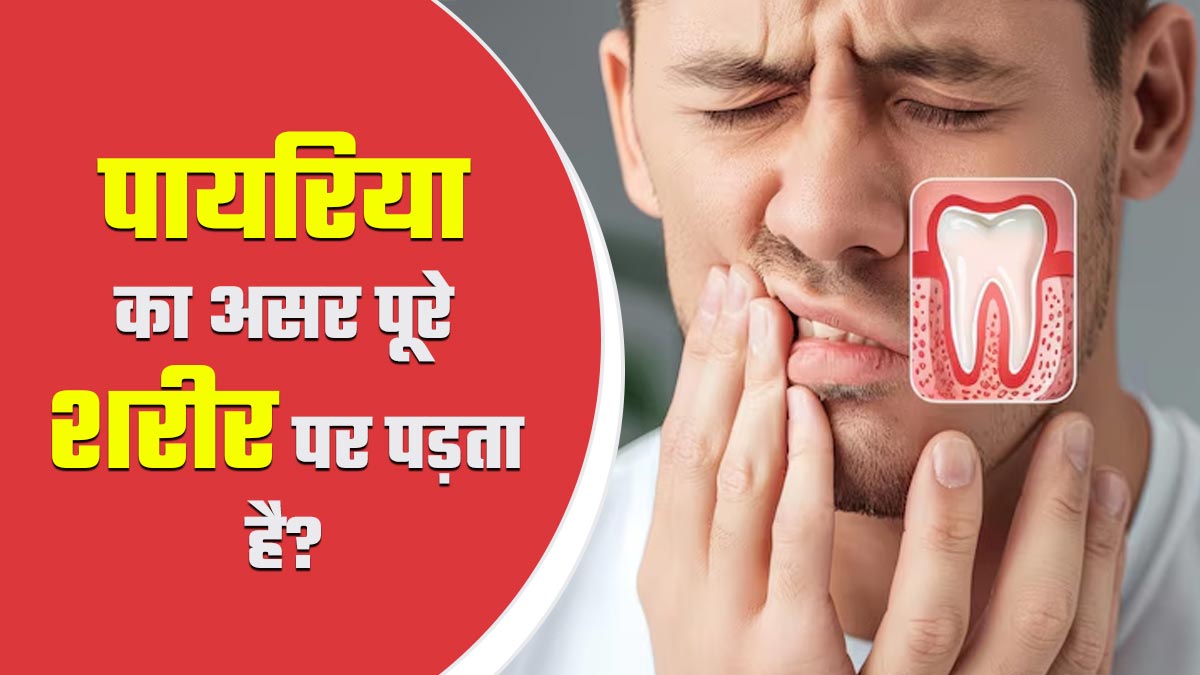 क्‍या दांतों में पायर‍िया का असर पूरे शरीर पर पड़ सकता है? एक्‍सपर्ट से जानें