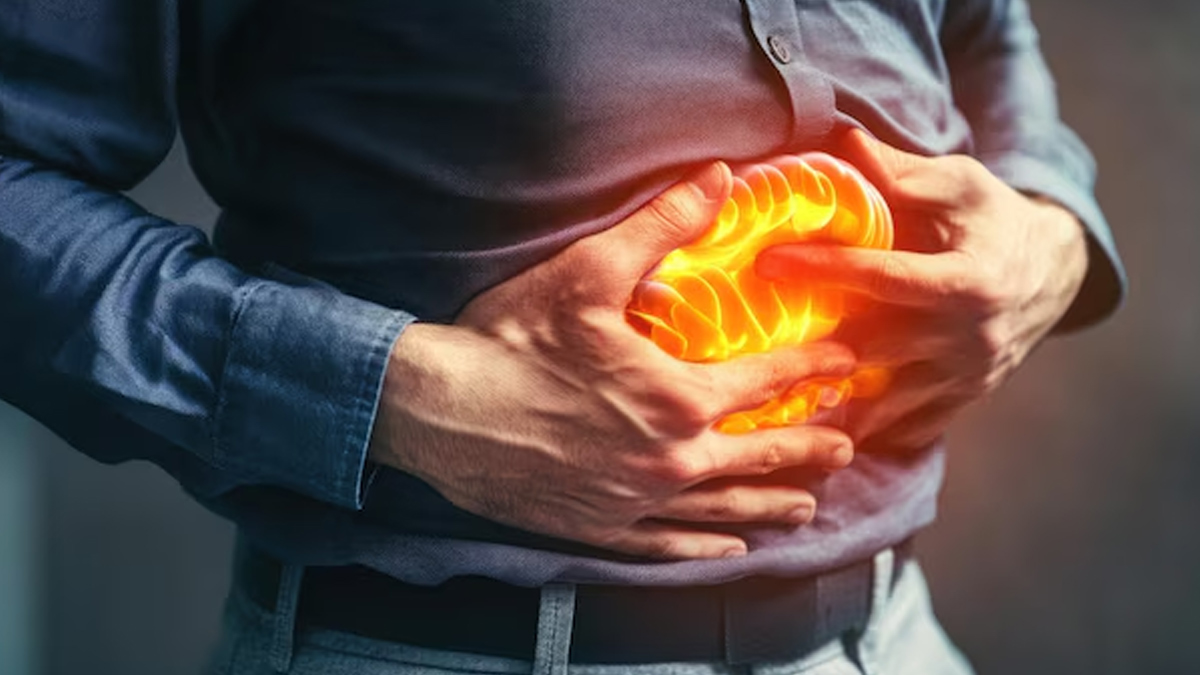 bloating-acidity-difference