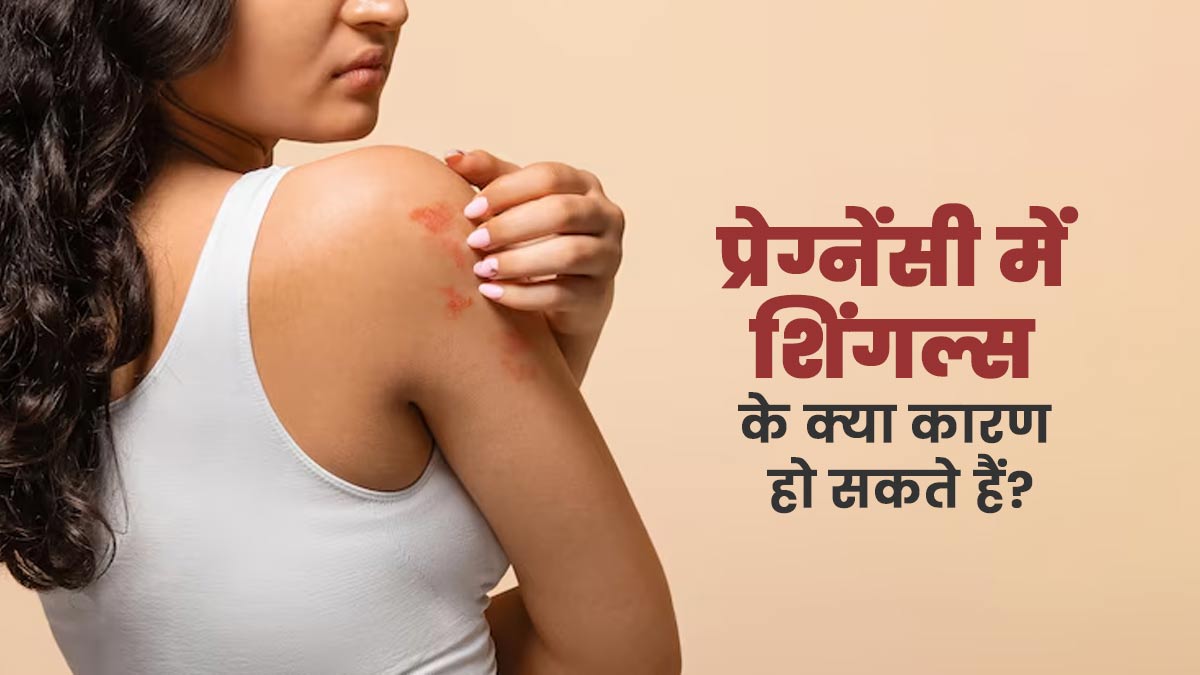 प्रेग्नेंसी में शिंगल्स के क्या कारण हो सकते हैं? जानें इसके लक्षण