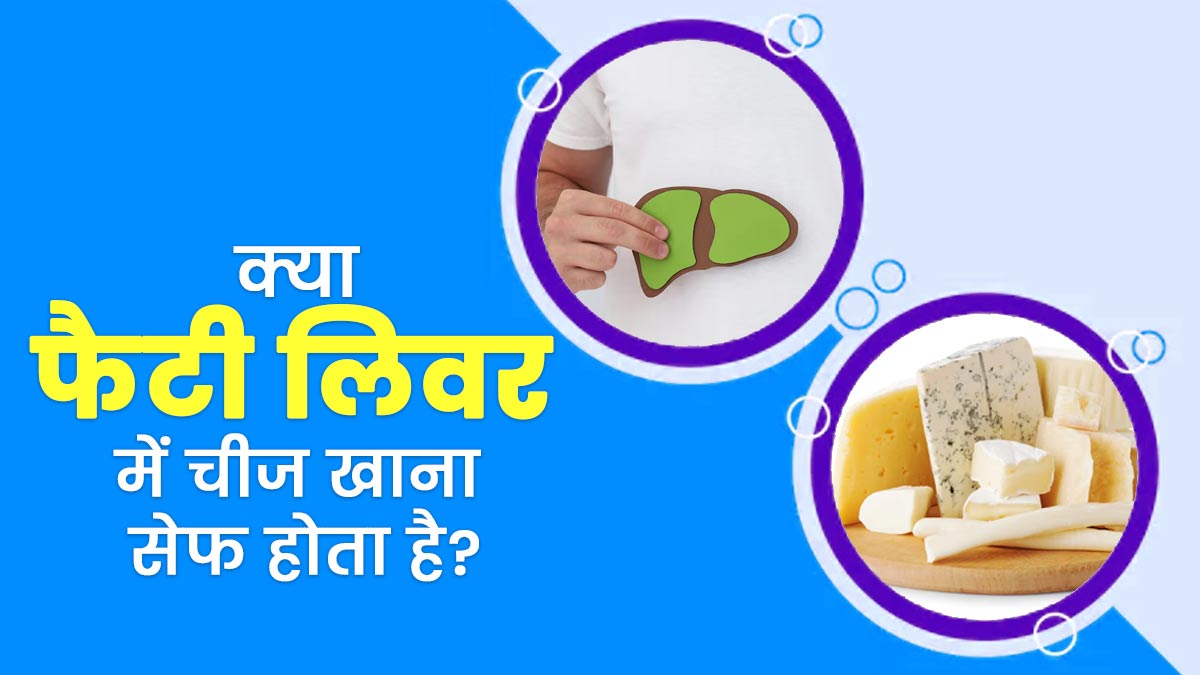 क्या फैटी लिवर में चीज खाना सुरक्षित होता है? एक्सपर्ट से जानें इसके फायदे-नुकसान