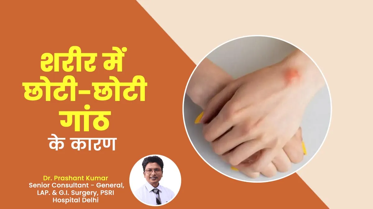 शरीर में छोटी-छोटी गांठ क्यों बनती है? डॉक्टर से जानें इसके कारण और बचाव के उपाय