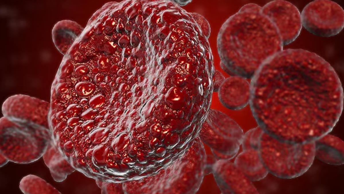 What-areas-are-affected-by-sickle-cell-anemia