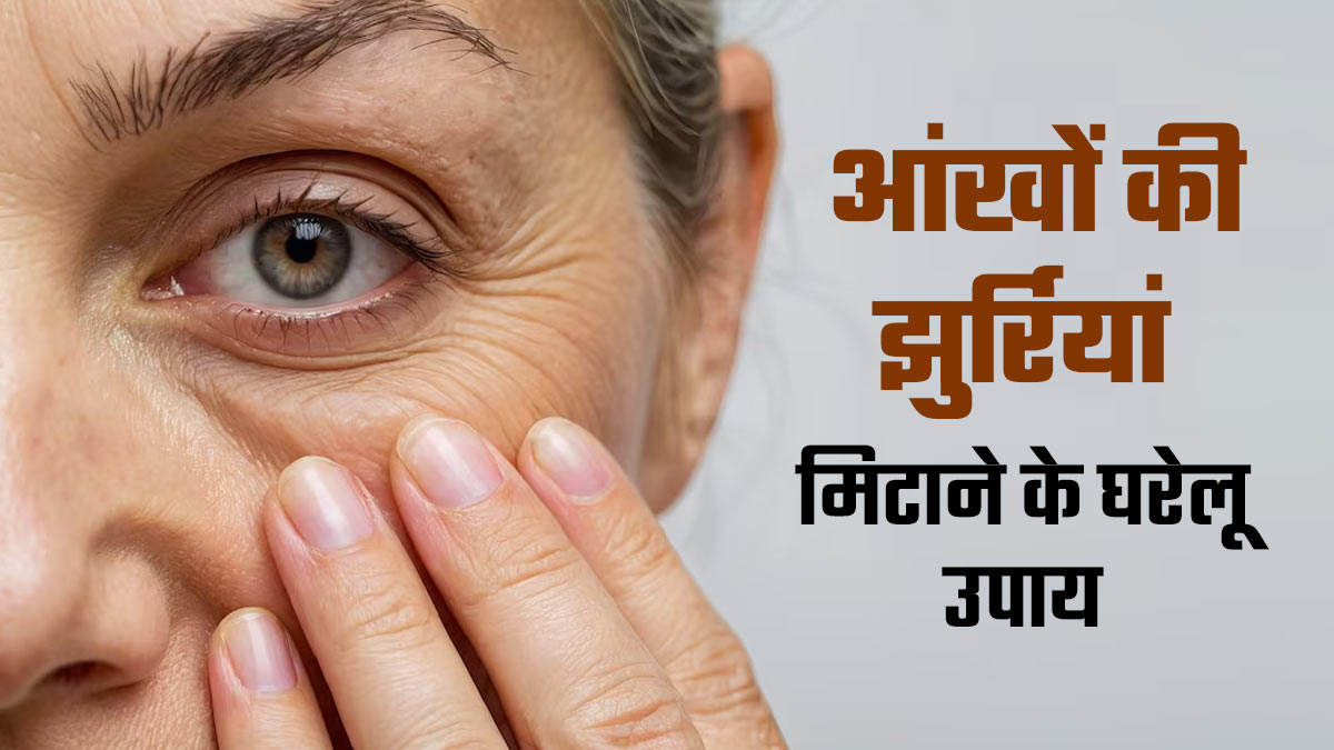 आंखों के किनारे मौजूद झुर्रियों को दूर करेंगे ये 5 घरेलू उपाय, जल्‍द द‍िखेगा असर