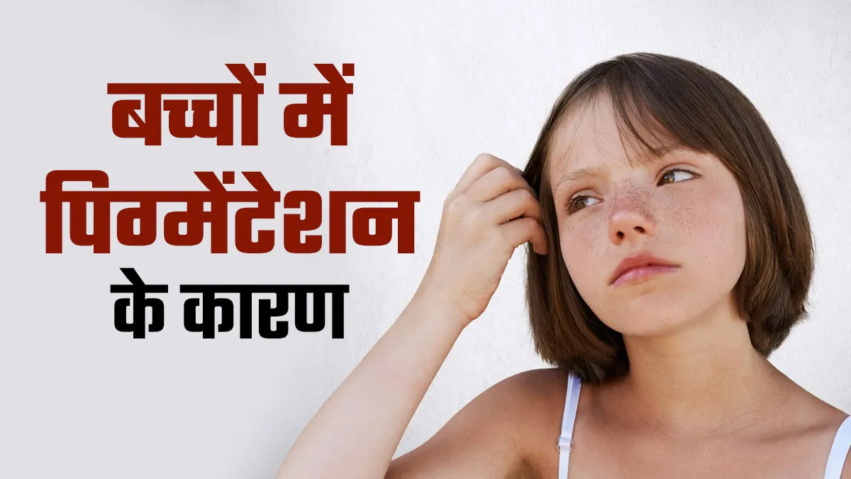 बच्चों में भी हो सकता है पिग्मेंटेशन, डॉक्‍टर ने बताए 5 कारण