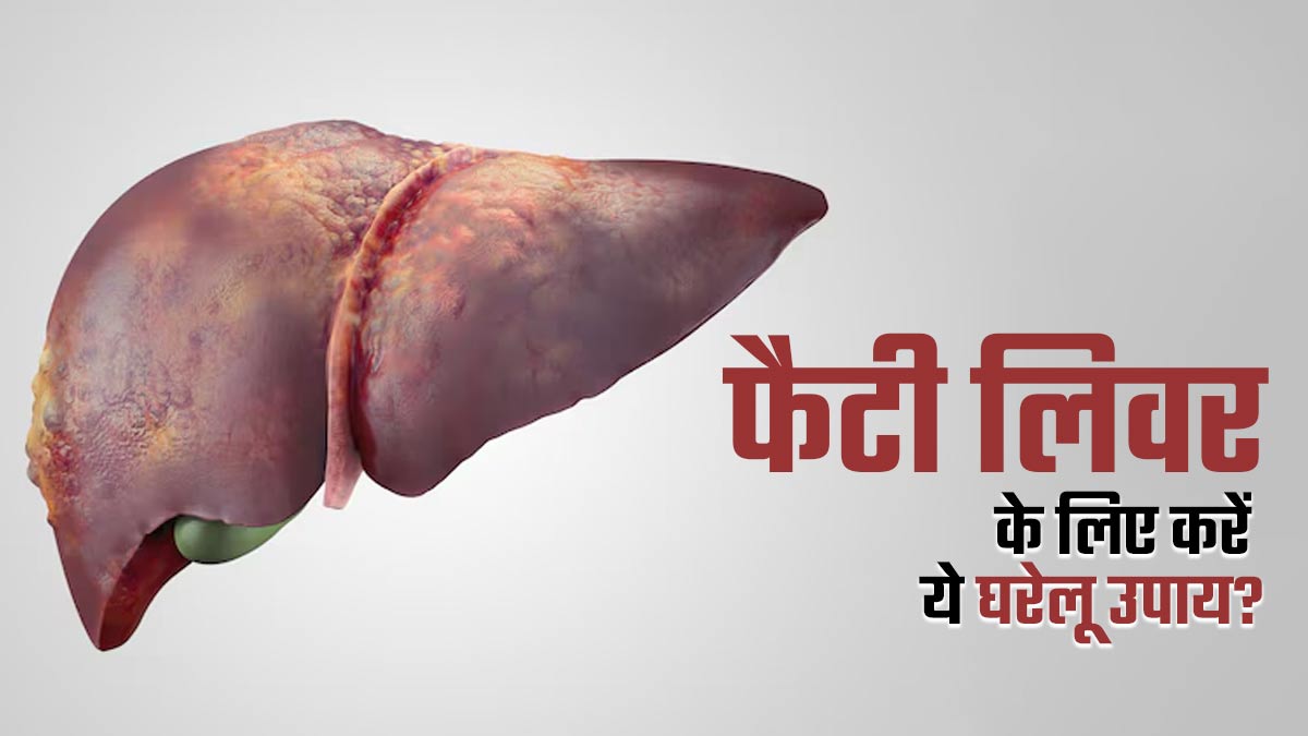 फैटी लिवर के लिए करें ये घरेलू उपाय, एक्सपर्ट से जानें