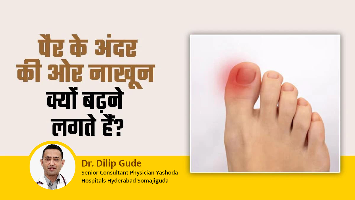पैर के अंदर की ओर नाखून क्यों बढ़ने लगते हैं? डॉक्टर से समझें