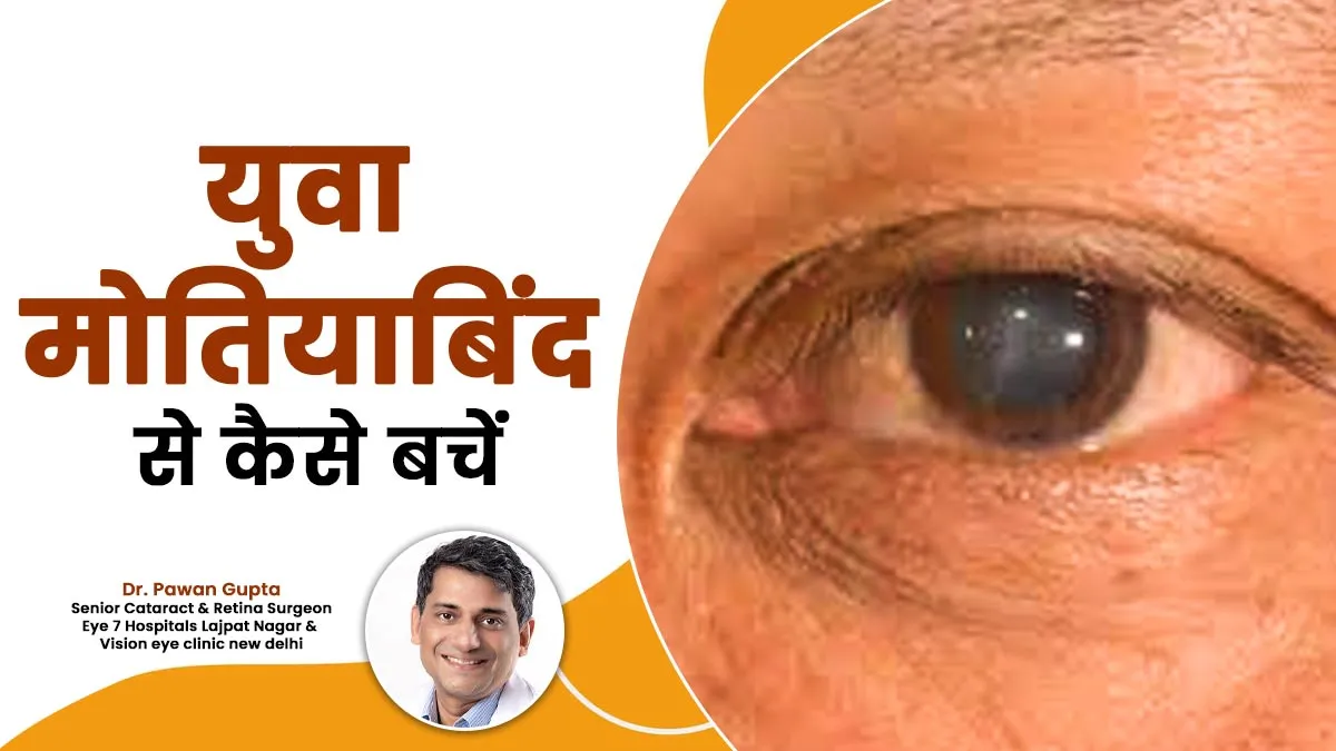 युवाओं में बढ़ रहे हैं मोतियाबिंद के मामले, डॉक्टर ने बताया इसका कारण और इलाज