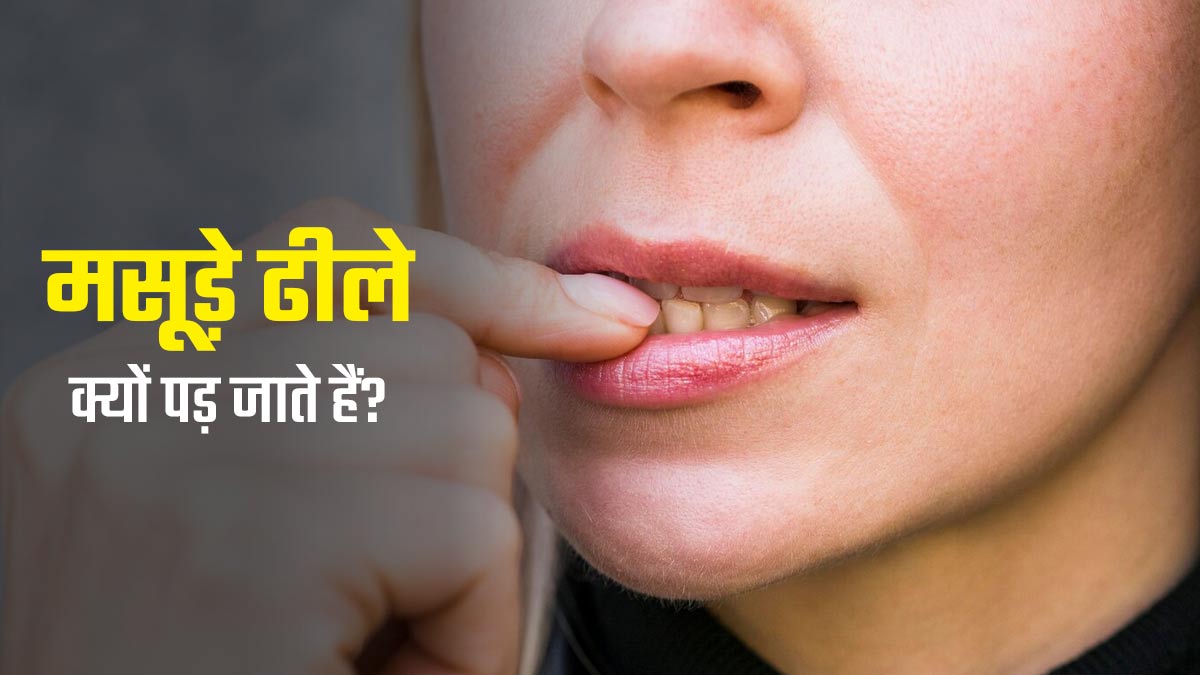 मसूड़े ढीले क्यों पड़ जाते हैं? डॉक्टर से जानें कारण