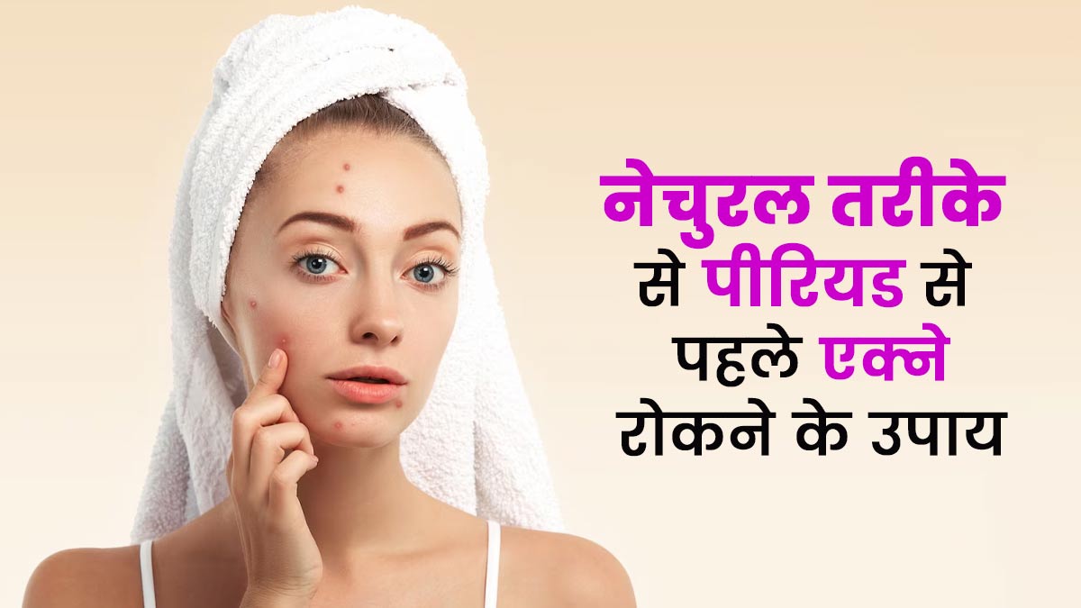 नेचुरल तरीके से पीरियड से पहले मुंहासों को कैसे रोकें? डॉक्टर से जानें